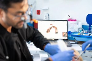 Dental technician wearing blue gloves examining 3D digital dental scan of teeth arch displayed on computer monitor in dental laboratory